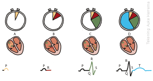 Wat Is Een Ecg Scan