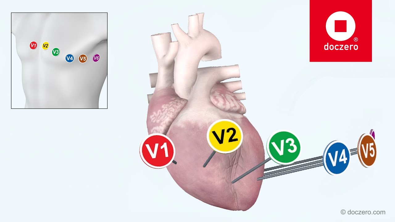 Snelle Interpretatie Van Ecg's Pdf
