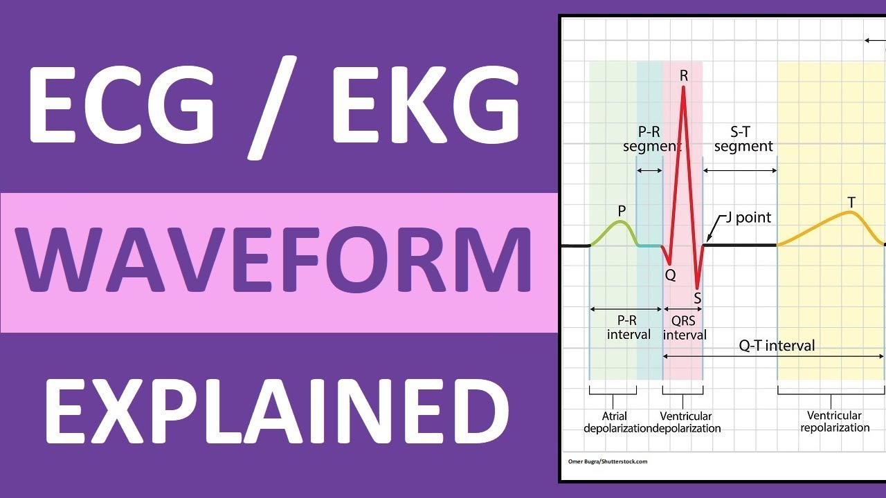 ECG Waveform Explained and Labeled | ECG Interpretation Nursing NCLEX - Negatieve T Top Ecg Betekenis