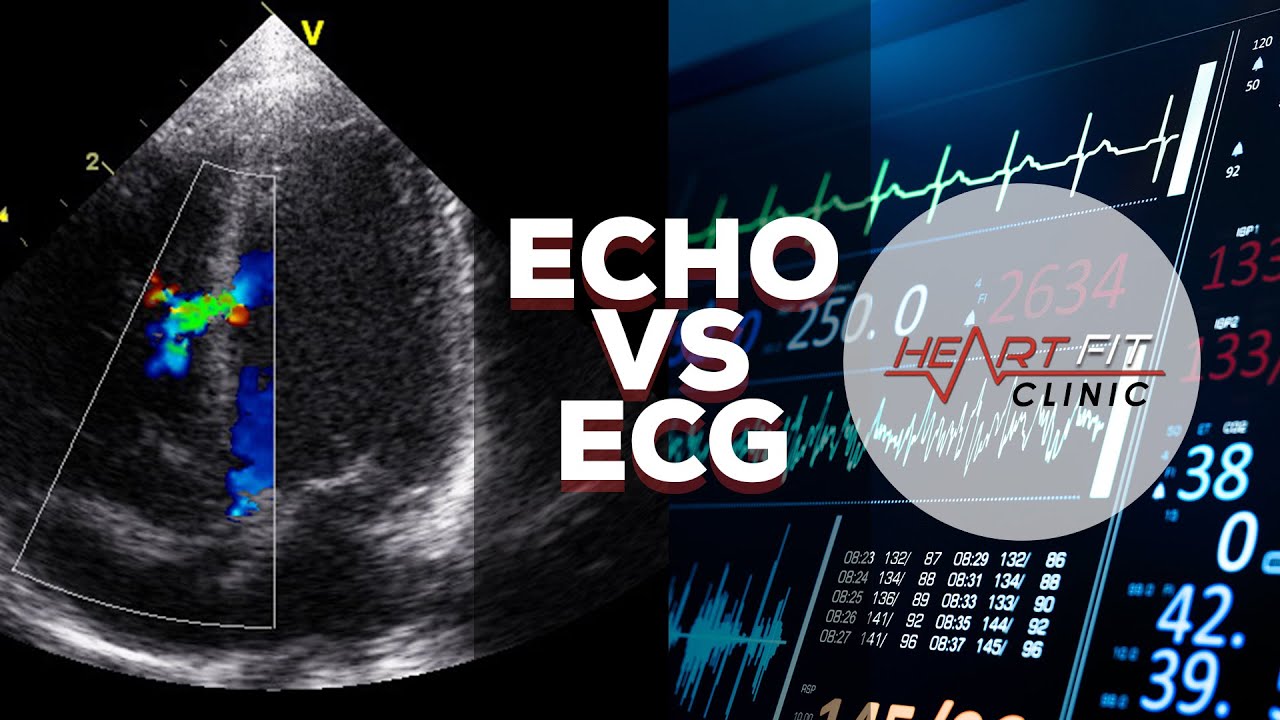 Echocardiogram vs Electrocardiogram - YouTube - Verschil Tussen Echo En Scan