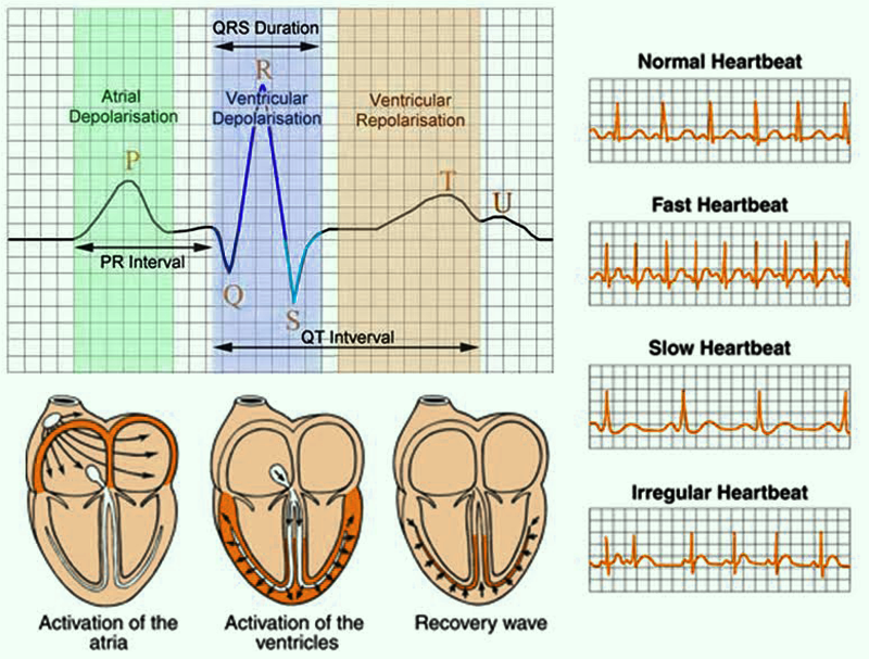 Electrocardiogram Test (ECG) : Procedure,Types and Medical Uses - Wat Is Een Ecg Scan