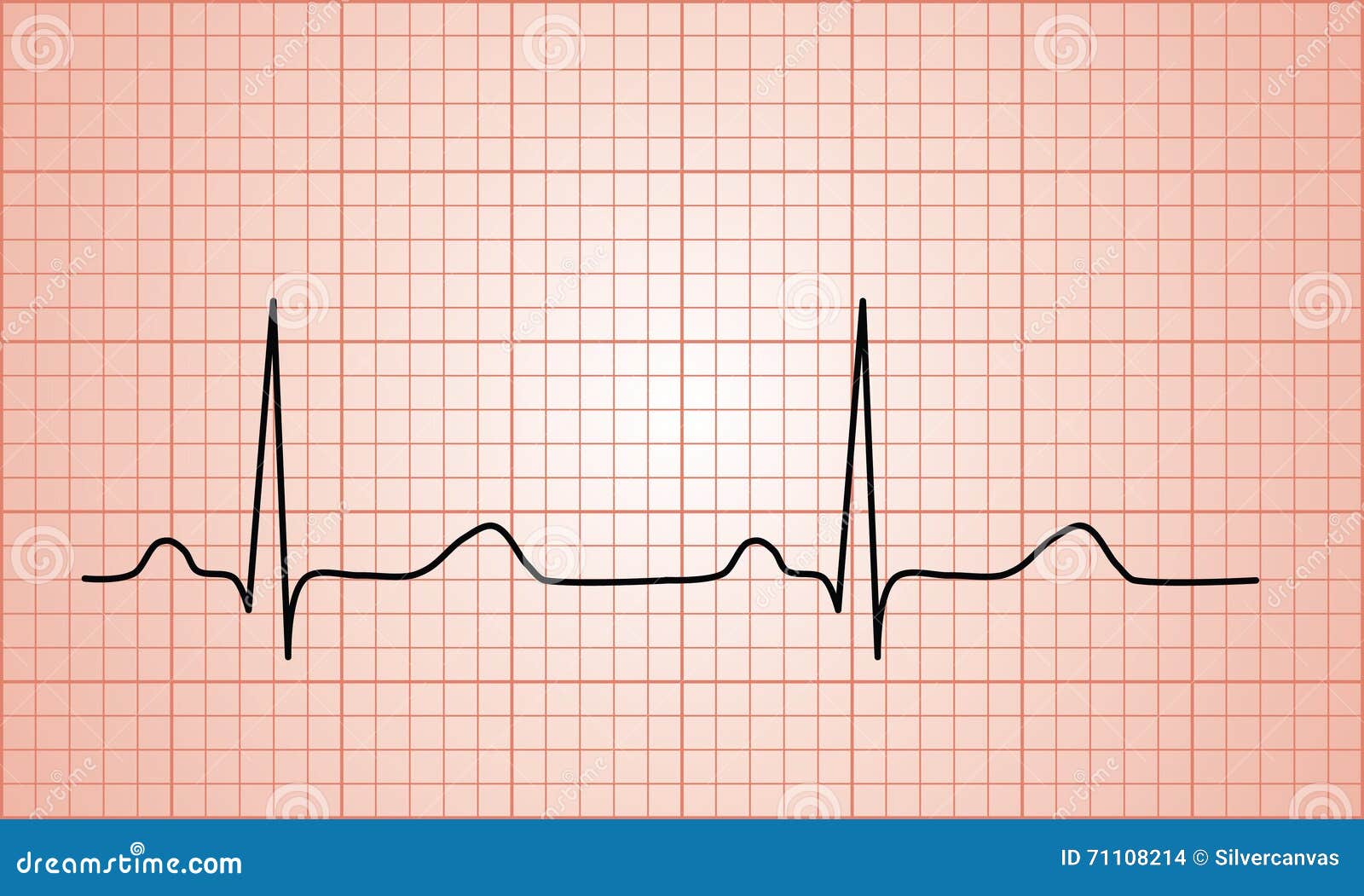 Electrocardiograma Normal 1,900+ Normal Ecg Stock Photos, Pictures - Wat Is Een Normale Hardslag