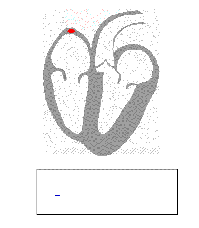 Elektrocardiogram - Wikipedia - Zie Ginds Komt De Stoomboot Lyrics