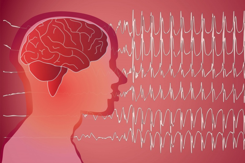 Epilepsie Aanval - Welke Soorten Epilepsie Zijn Er