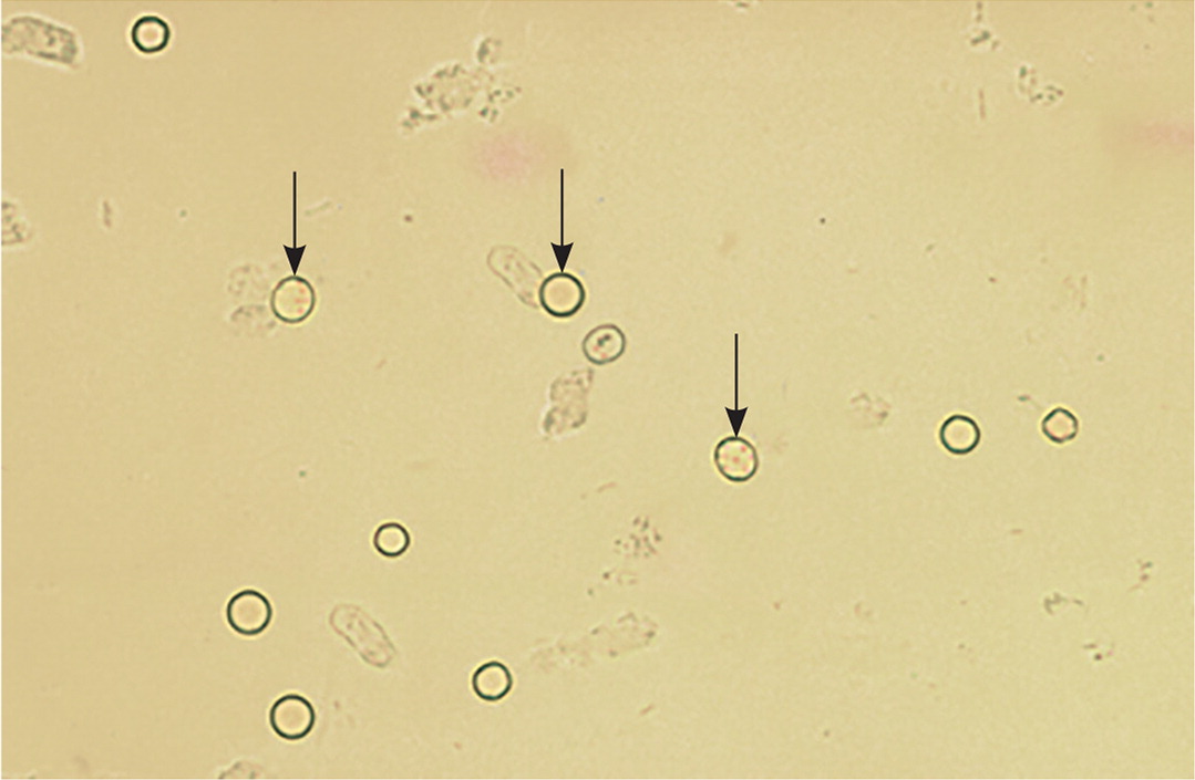 FIGURE 3. - Erytrocyten In Urine Waarde 1