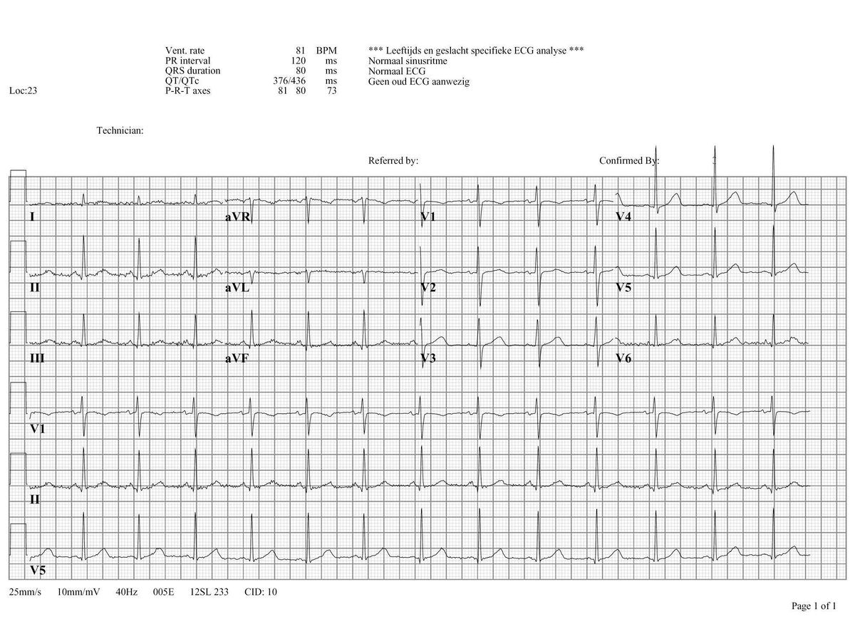 File:Normaal ecg.jpg - ECGpedia - Hoe Ziet Een Normale Ecg Eruit