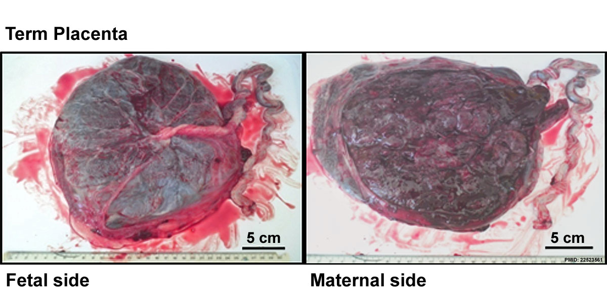 File:Placenta term anatomy 01.jpg - Embryology - Zit De Baby In De Placenta
