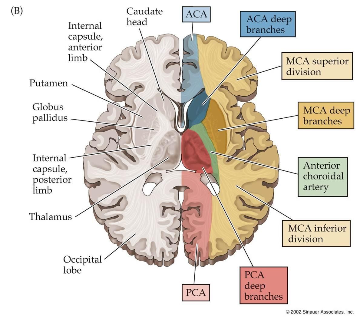 Flashcards - Lect 23 - Aphasias and Cortical Syndromes - Broca's - Arteria Cerebri Media M1 M2 M3