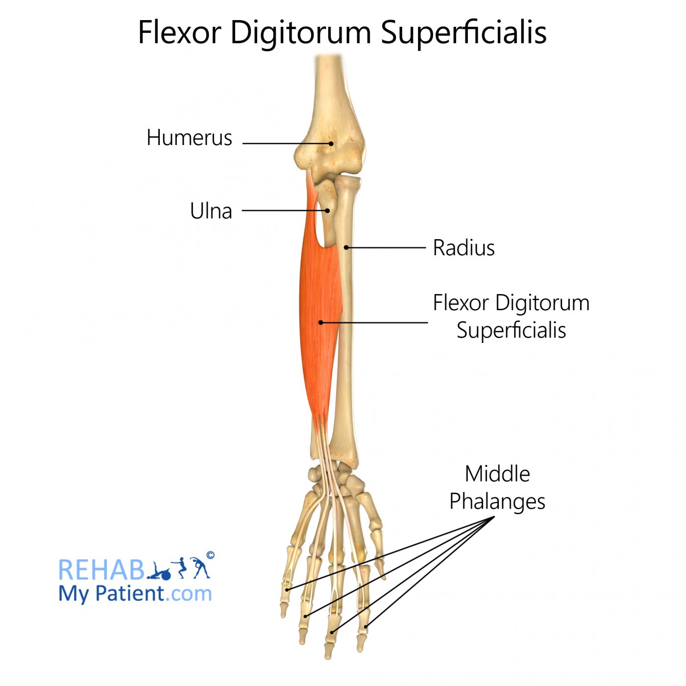 Flexor Digitorum Longus Pijn Hardlopen