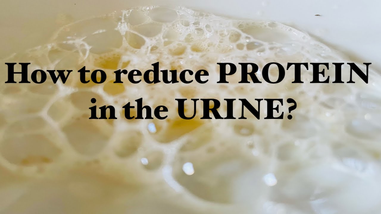 food causing protein in urine Diet for protein in urine - Teveel Eiwit In Urine Oorzaak