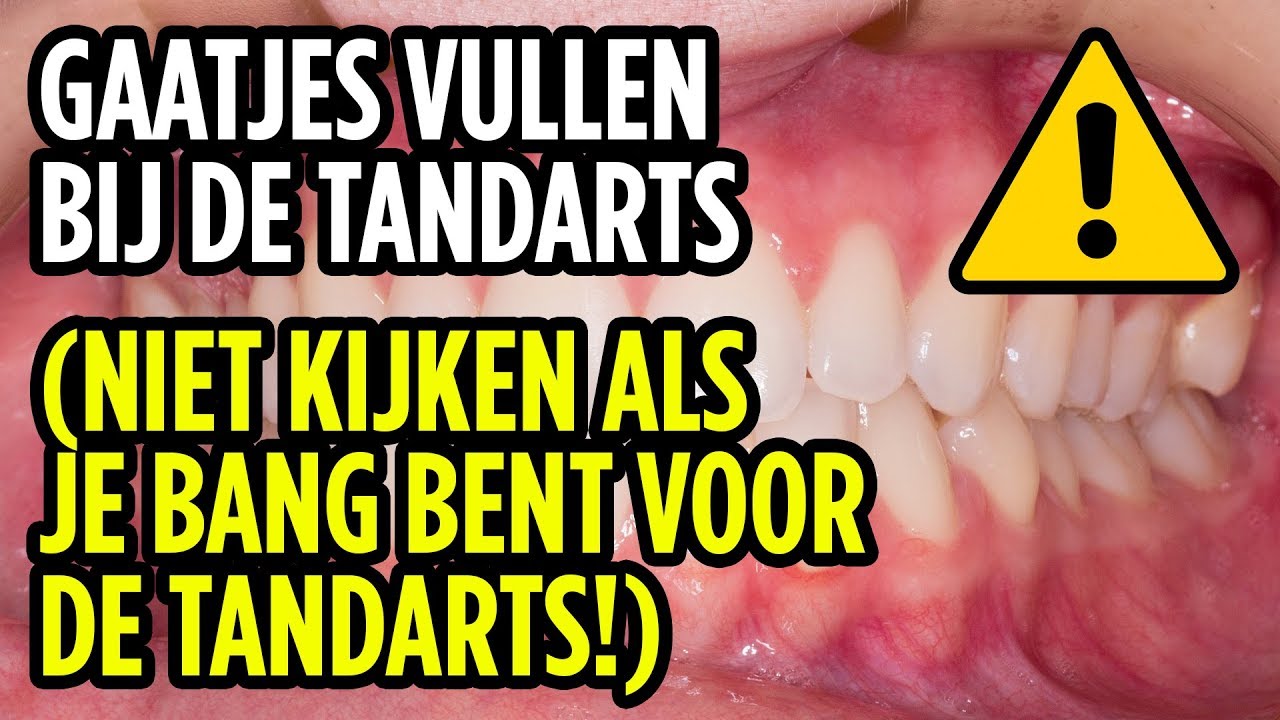 Gaatjes Vullen Bij De Tandarts / Filling Cavities At The Dentist (ENG - Hoeveel Voortanden Heeft Een Papegaai 4 Letters