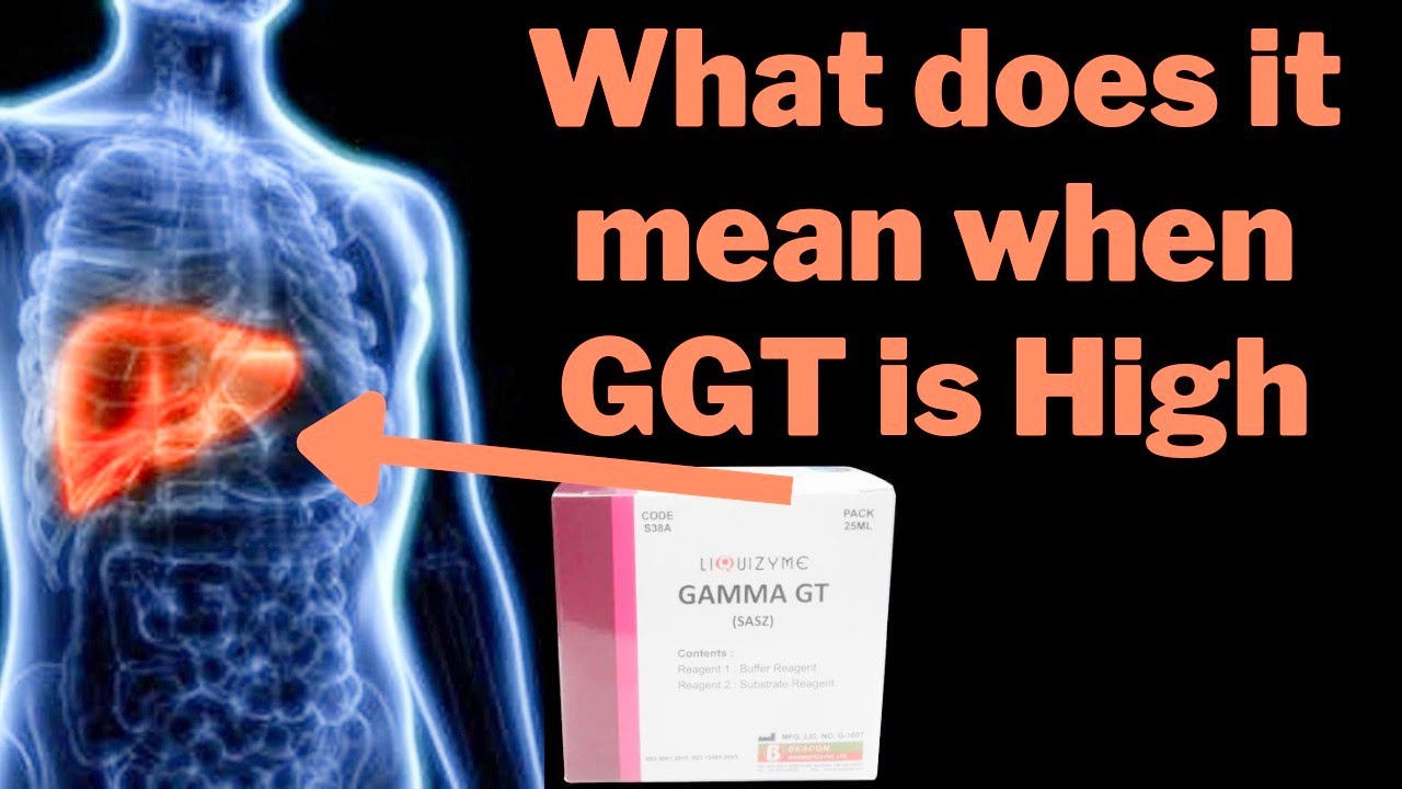 Gamma-glutamyl Transferase (GGT test ) How to Control the high level of - Alat En Gamma Gt Verhoogd