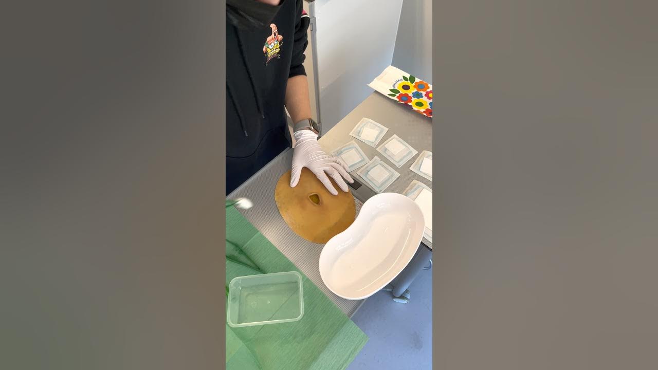 Gele wond verzorgen - YouTube - Gele Wond Met Fibrine Behandeling