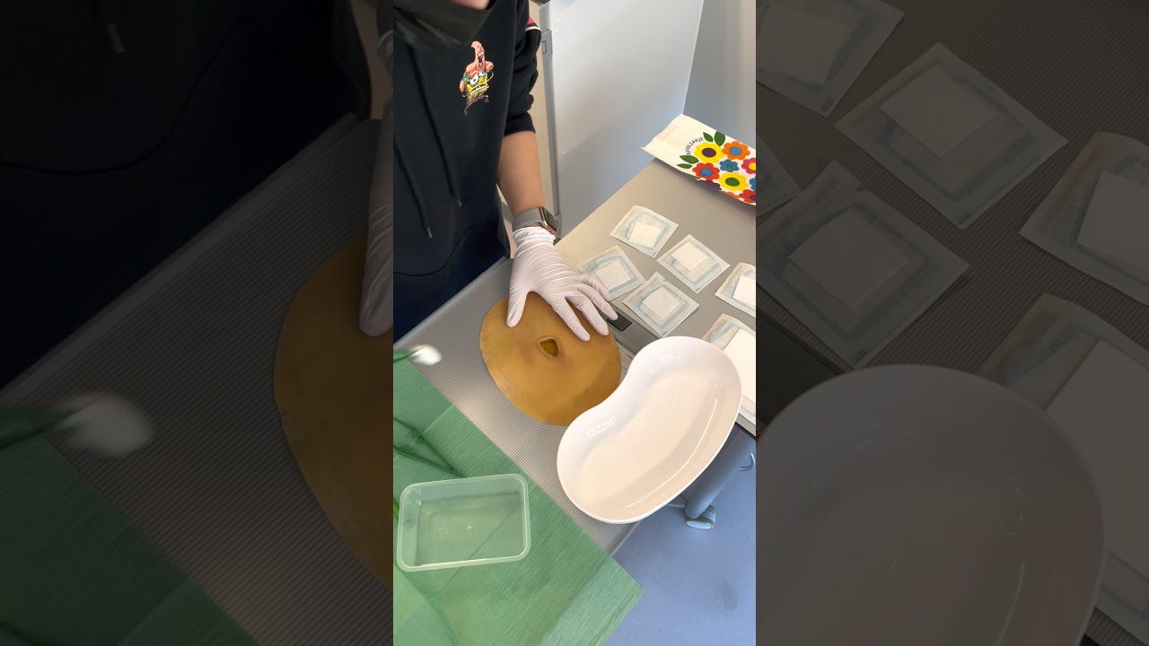 Gele wond verzorgen - YouTube - Gele Wond Met Fibrine Vochtig Houden