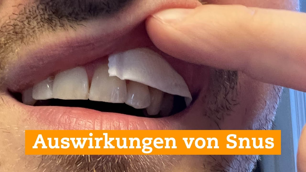 Wat Zit Er In Snus