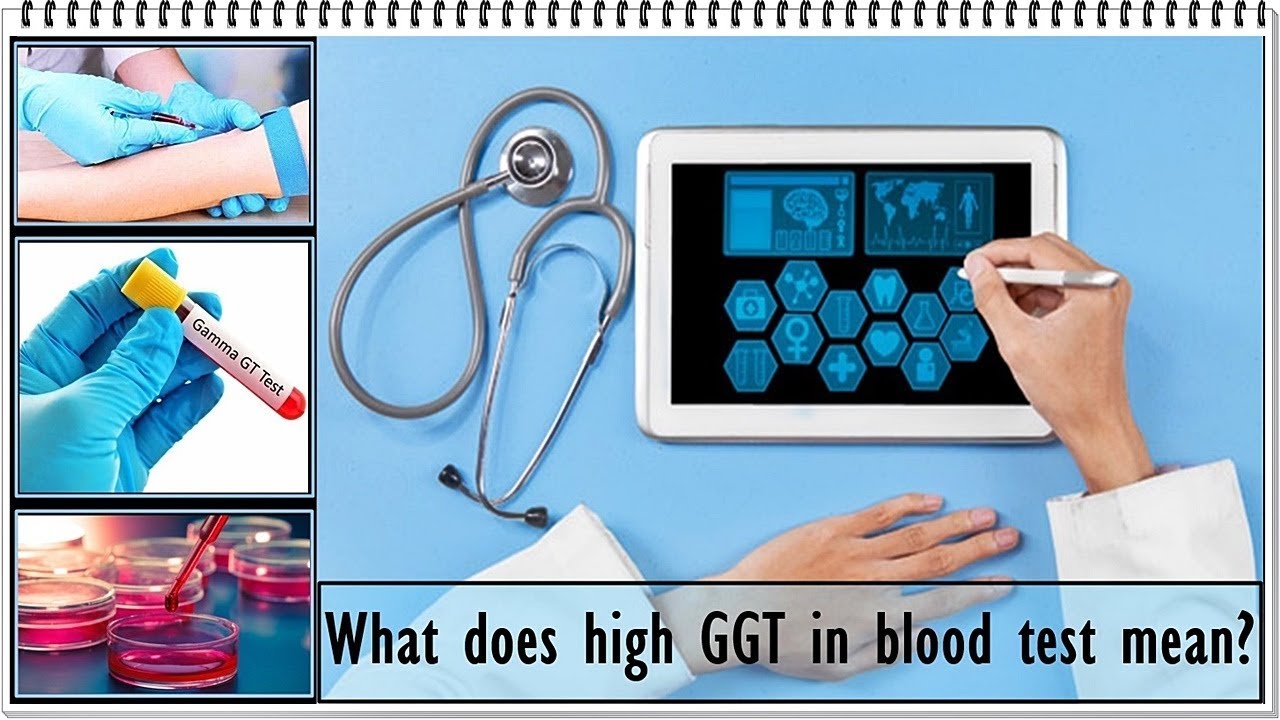 Wat Is Ggt In Bloedonderzoek