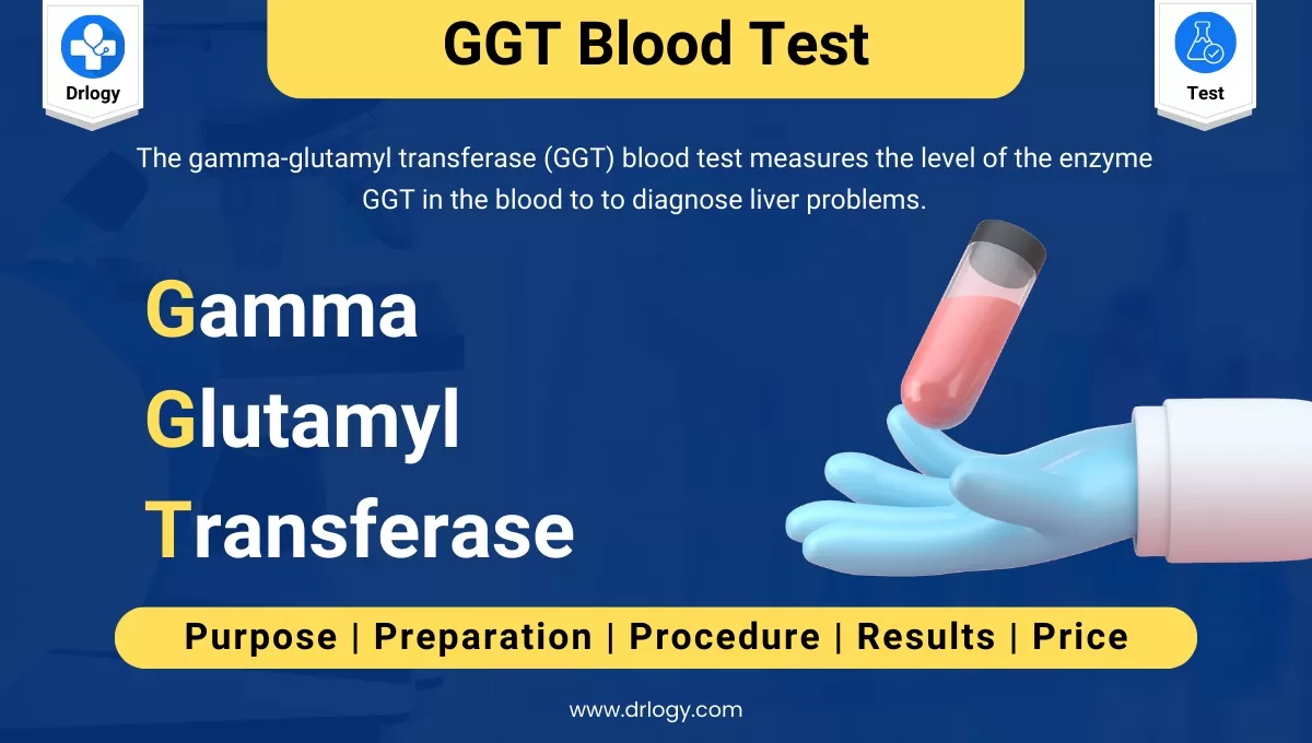 GGT Blood Test: Understanding Key Insights, 03/14/2024 - Wat Is Ggt In Het Bloed