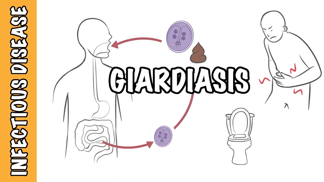 Hoe Ziet Giardia Ontlasting Eruit
