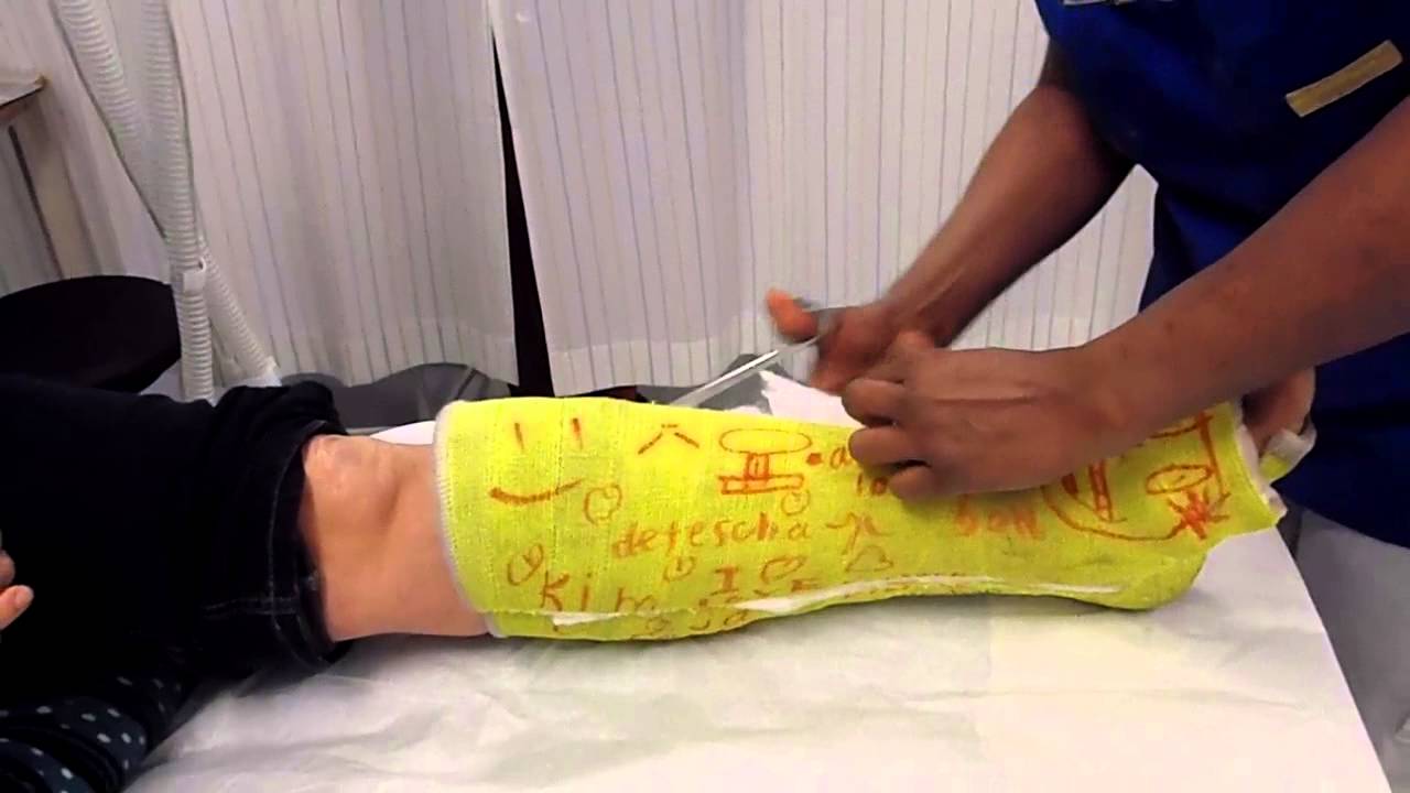 gips eraf - YouTube - Eraf Halen Of Er Af Halen