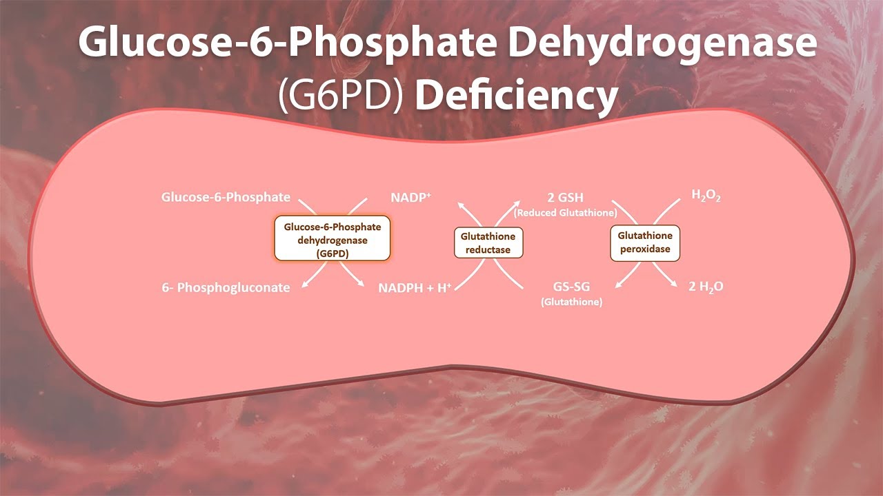 Glucose-6-Phosphate Dehydrogenase deficiency - G6PD deficiency - Glucose 6 Fosfaat Dehydrogenase Deficientie
