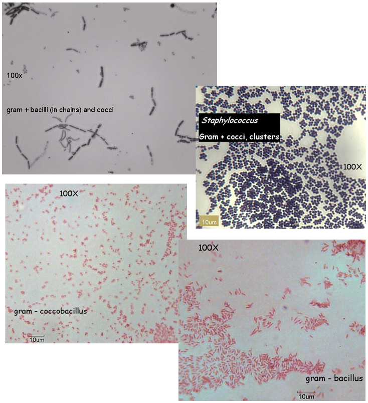 Gram Stain | Microbiology Lab - Gram Positief En Gram Negatief