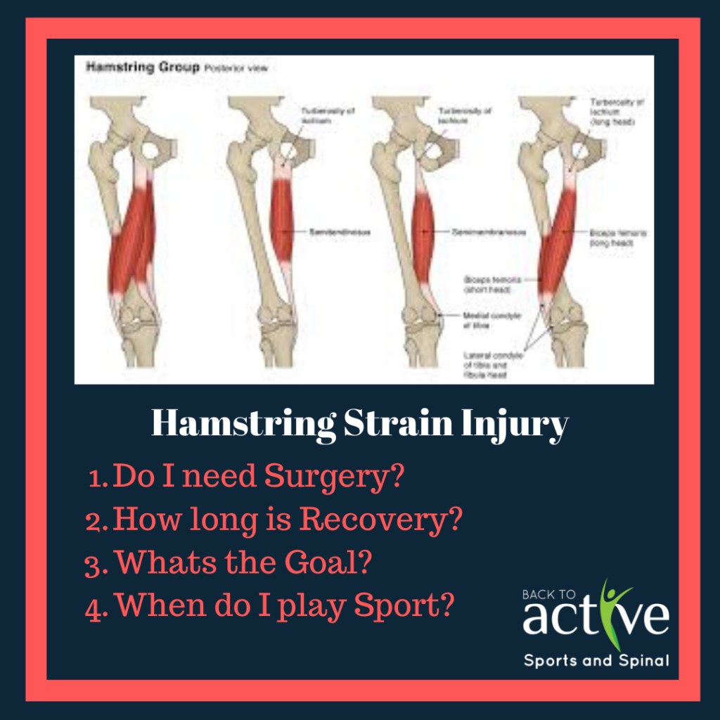 Hamstring Strain Injuries - Back to Active Sports and Spinal - Wat Is Een Hamstring Blessure
