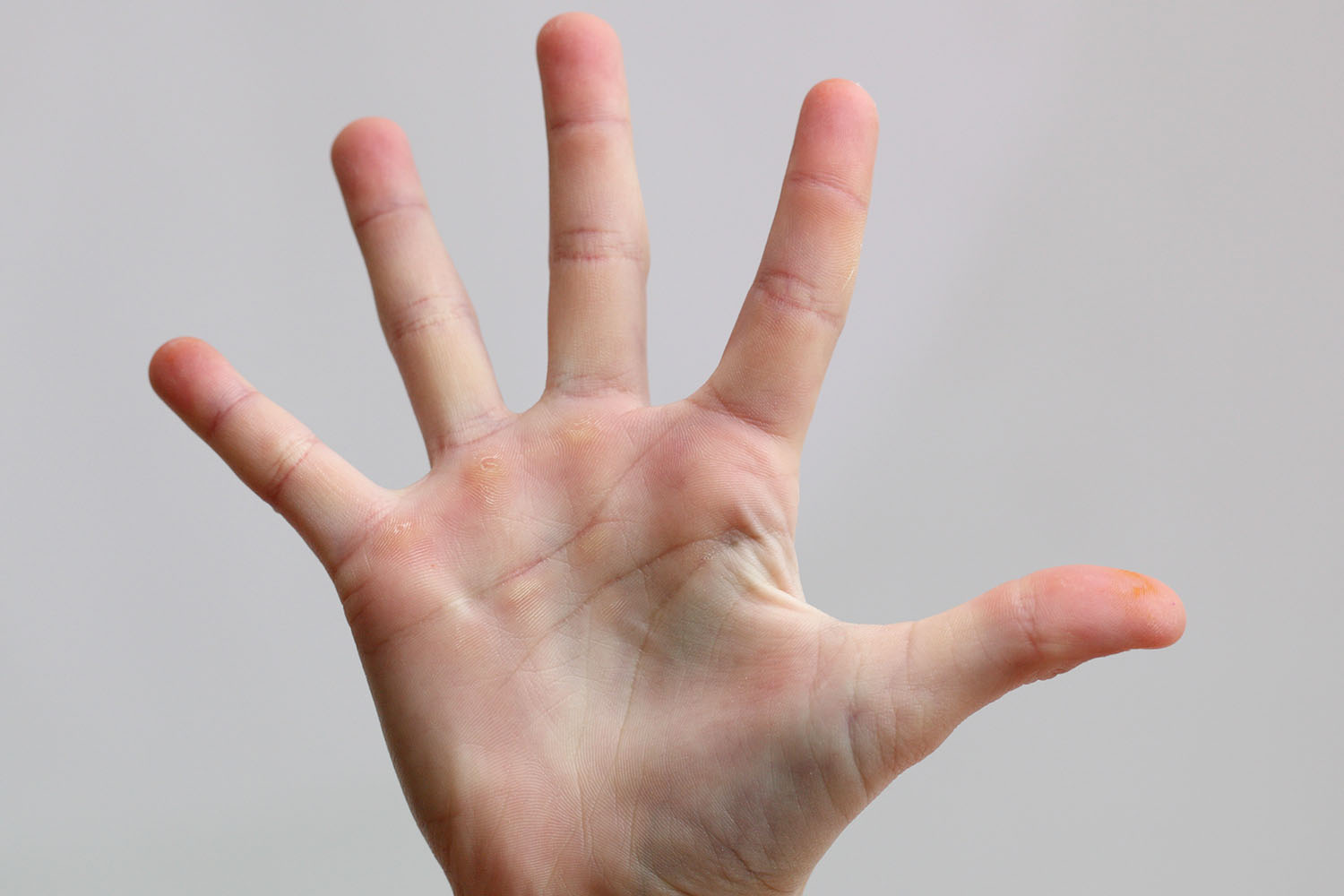 Hand Parts Name - Eremedium - Hand Mond En Voetziekte Kind