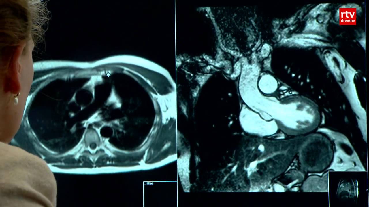 Hart-MRI maakt van ziekenhuis Bethesda hartzorgcentrum - YouTube - Wat Zie Je Op Een Rontgenfoto