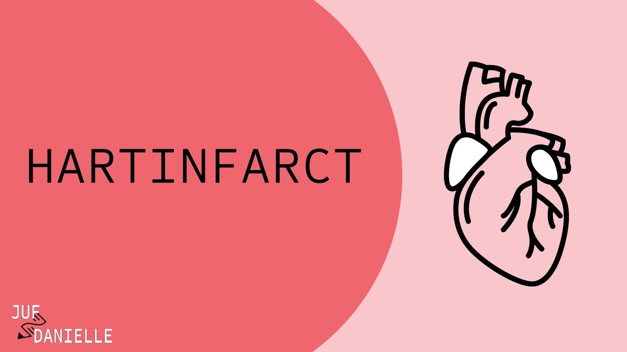 Hartinfarct: Oorzaken, symptomen, diagnose, complicaties en behandeling - Ook Vrouwen Krijgen Een Hartinfarct