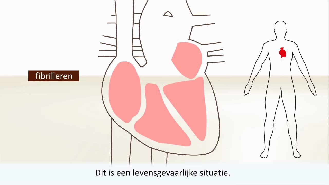 Hartritmestoornissen - Wat is een hartritmestoornis? - YouTube - Bij Welke P Hoort Dit Medicatie-incident