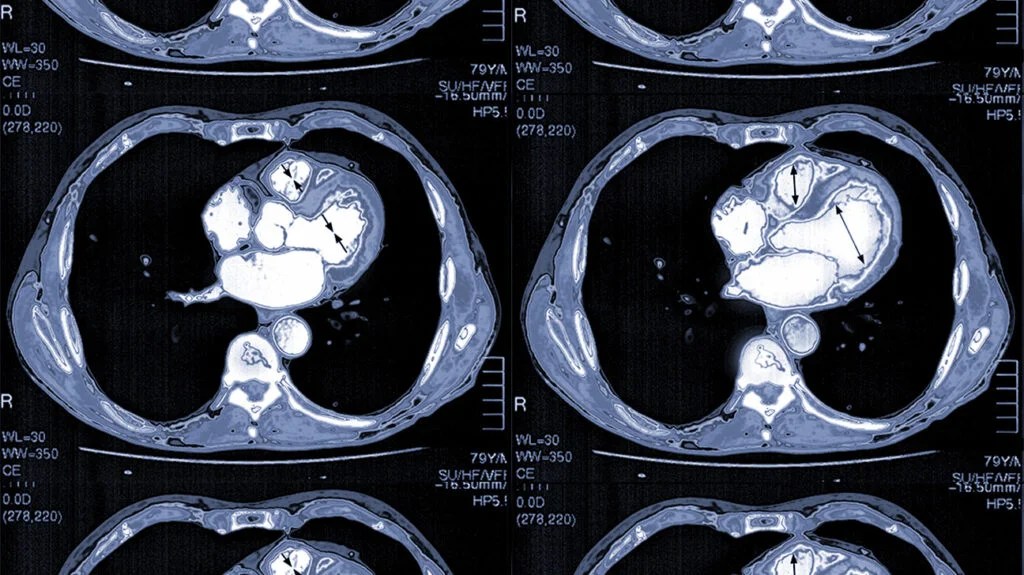 Ct Scan Van Het Hoofd