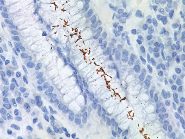 Helicobacter pylori Antibody - Biocare medical - Helicobacter Pylori Bacterie In Darmen