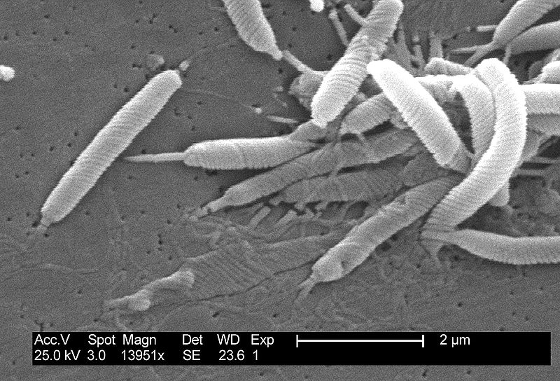 Helicobacter Pylori – howMed - Helicobacter Pylori Bacterie In Darmen