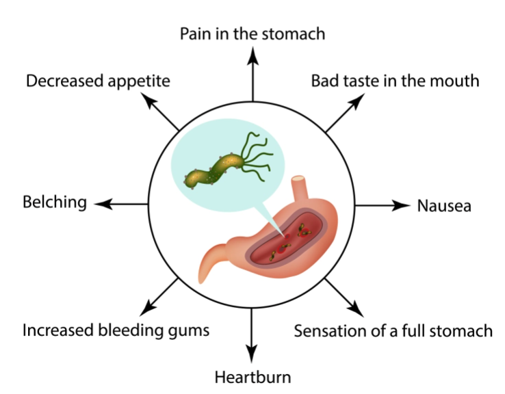 Helicobacter Pylori Test – TestEasy - Helicobacter Pylori Hoe Kom Je Eraan