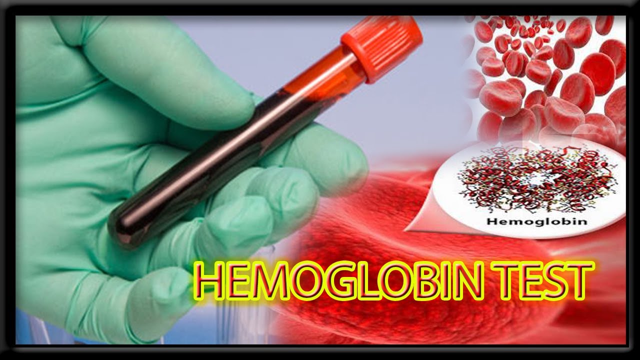 Hemoglobin Blood test # HGP | # Harib diagnostic lab - YouTube - Hematocriet En Hemoglobine Te Laag