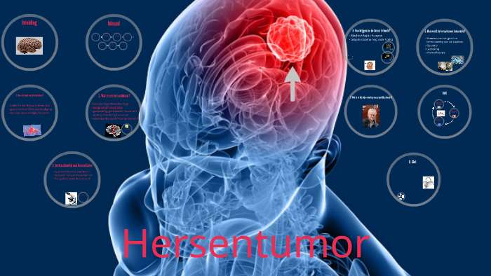 Hersentumor by jelmer de groot - Hoe Ziet Een Hersentumor Eruit Op Mri