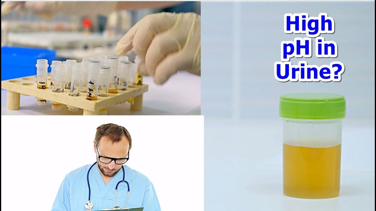 High pH in Urine - YouTube - Eiwit In Urine Te Hoog
