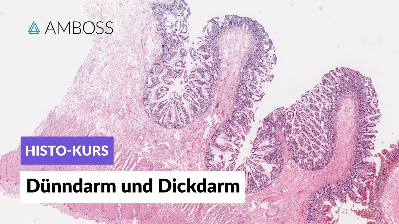 Histologie Dünndarm und Dickdarm - Mikroskopische Anatomie - AMBOSS - Hoe Lang Is Je Dunne Darm