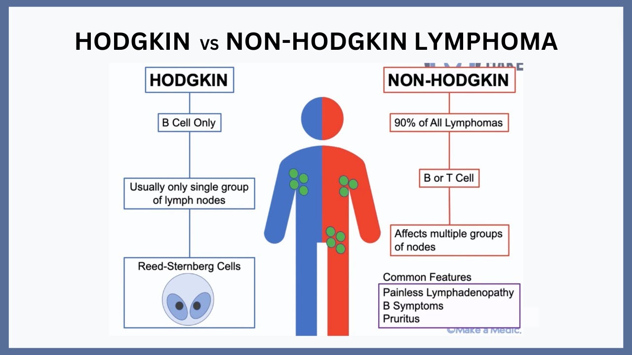 Hodgkin vs Non-Hodgkin Lymphoma Explained - YouTube - Verschil Non Hodgkin En Hodgkin