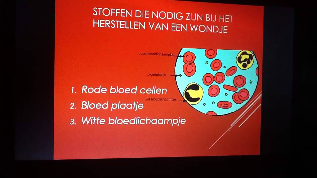 Hoe geneest een wondje - YouTube - Hoe Snel Geneest Een Wond