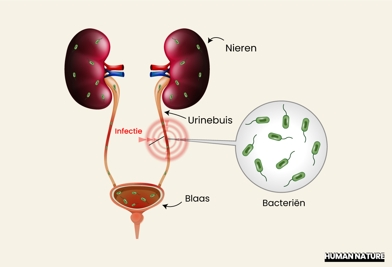Hoe Ontstaat een Blaasontsteking Bij mannen? - Human Nature - Hoe Snel Werkt Antibiotica Bij Blaasontsteking