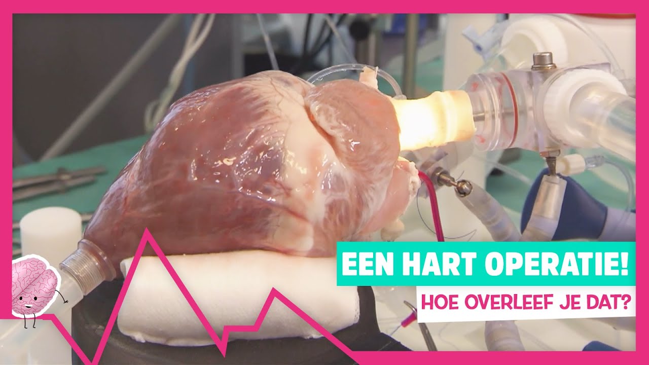 HOE OVERLEEF JE EEN HARTOPERATIE?! - TOPDOKS - YouTube - Iemand Iets Op Het Hart Binden