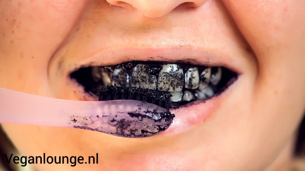 Welke Tandpasta Voor Wittere Tanden