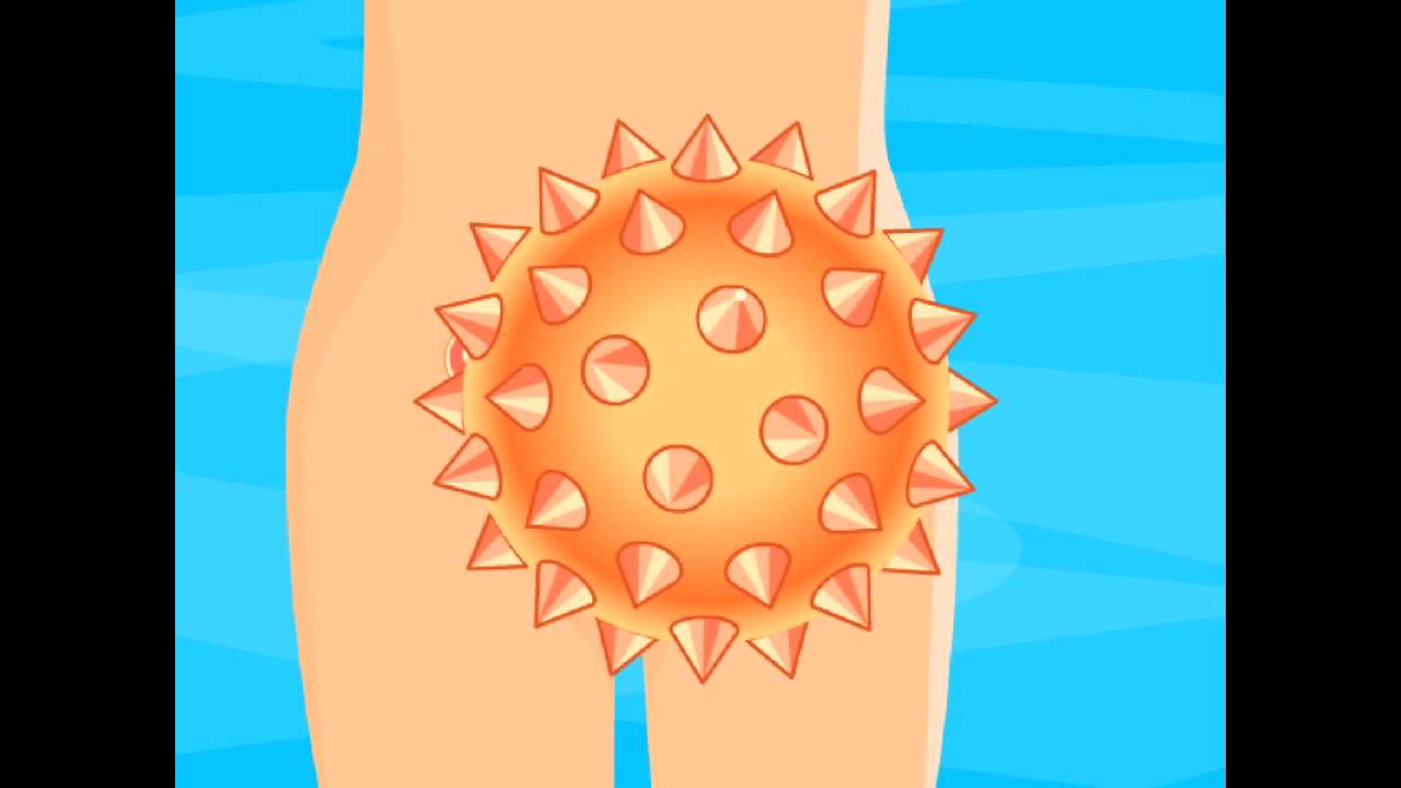 Hoe werkt de HPV-prik tegen baarmoederhalskanker - YouTube - Hoe Kom Je Aan Baarmoederhalskanker