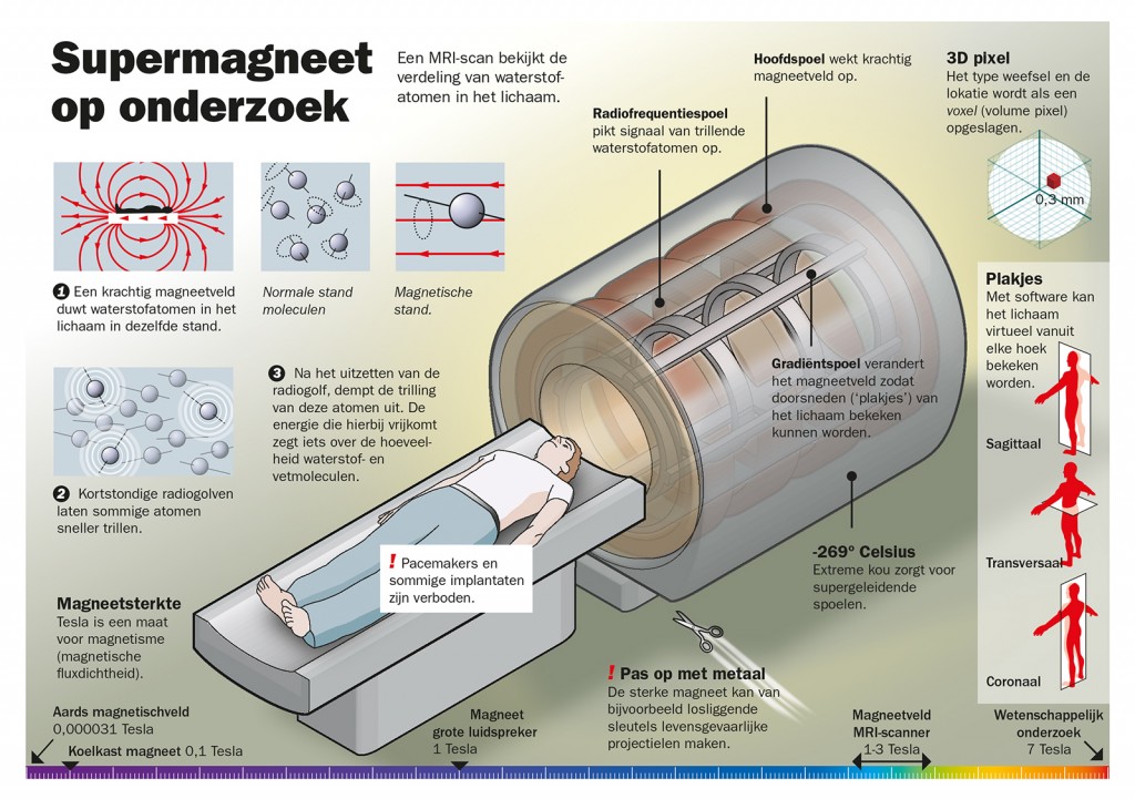 Hoe Werkt Een Mri Scan