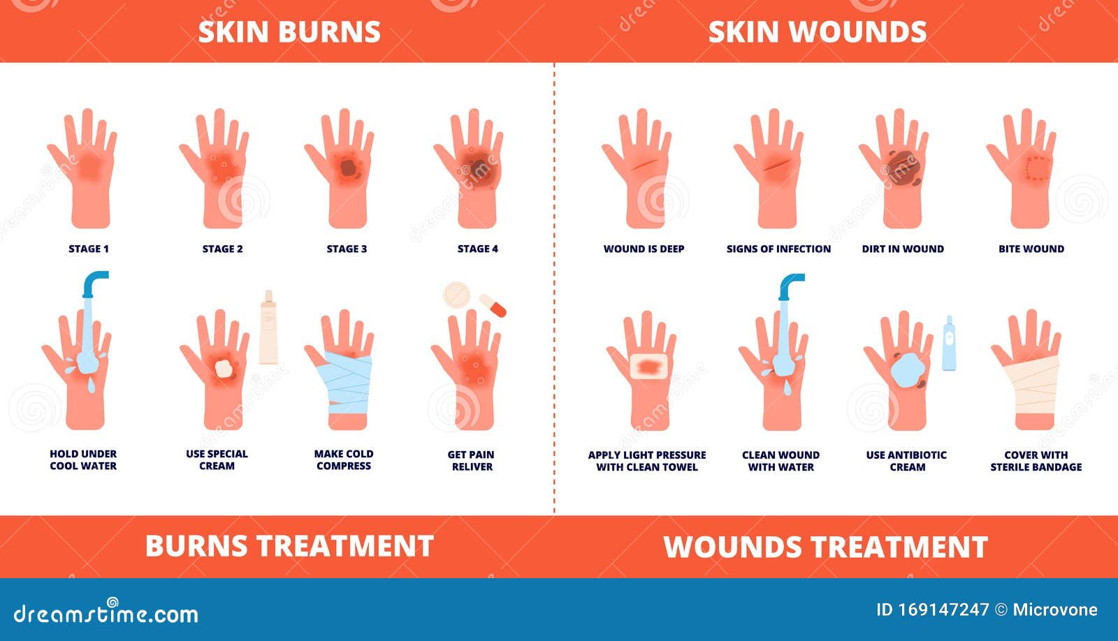 How To Help Burns - Memberfeeling16 - Wat Te Smeren Op Brandwond