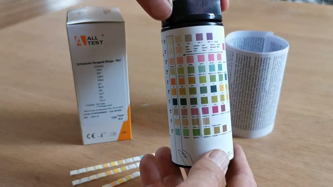 Welke Kleur Urine Bij Nierfalen