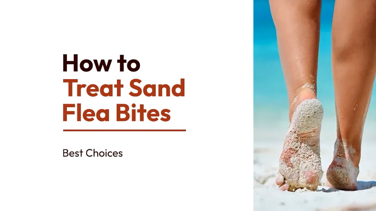 How to Treat Sand Flea Bites | Soothe Itchy, Irritated Skin Fast | Best - Dop Vast Aan Fles Irritant