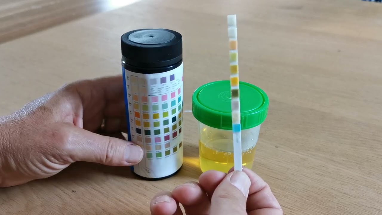Urine Nitriet Positief Leukocyten Negatief