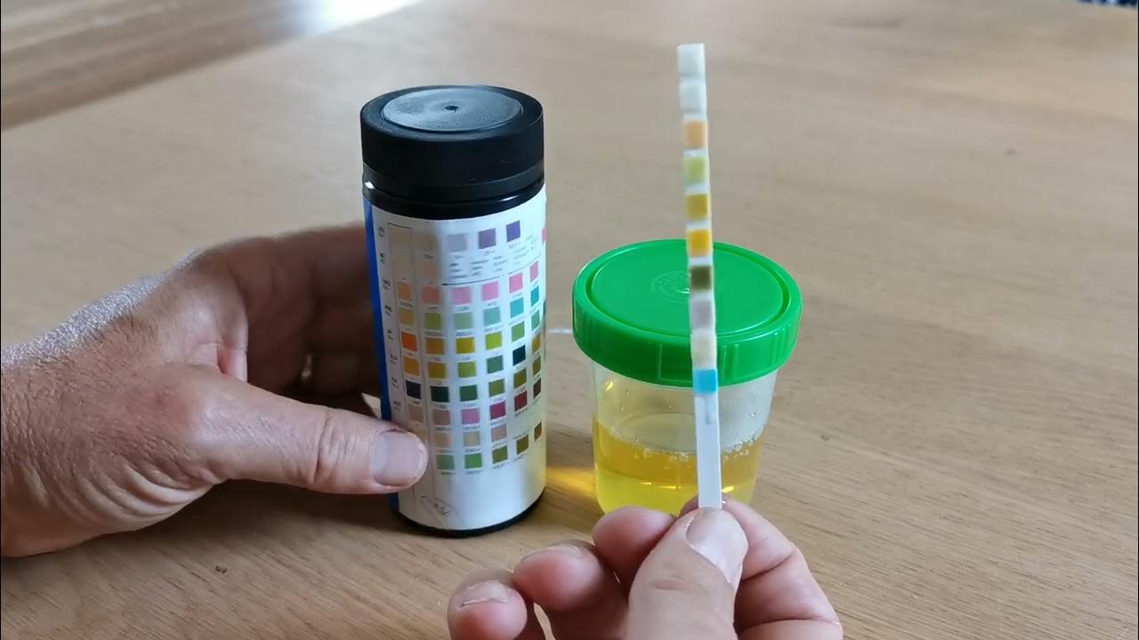 How to use urine test strips 10 parameters - YouTube - Blaas Urine Test Strips Aflezen